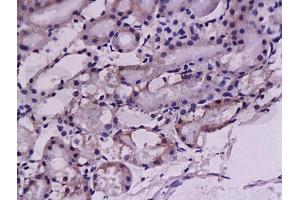 anti-Prepro-Endothelin-1 (AA 16-110) antibody