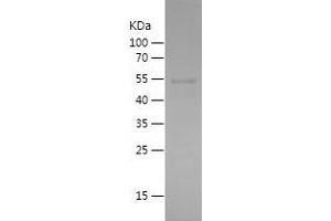 Western Blotting (WB) image for Sortilin 1 (SORT1) (AA 532-831) protein (His-IF2DI Tag) (ABIN7125175)