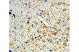 Used in DAB staining on fromalin fixed paraffin-embedded Brain tissue (Dermatopontin anticorps  (AA 26-197))