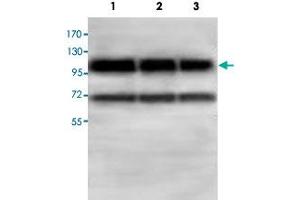 Western blot analysis of HepG2 (Lane 1) and 293T (Lane 2) and HeLa cell lysates with ABCF1 polyclonal antibody  at 1 : 500 dilution. (ABCF1 anticorps  (AA 580-837))