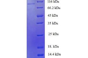 SDS-PAGE (SDS) image for Zinc Finger Protein 175 (ZNF175) (AA 1-711), (full length) protein (His-SUMO Tag) (ABIN5710648)