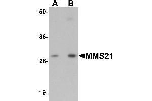 Western blot analysis of MMS21 in 293 cell lysate with MMS21 antibody at (A) 0. (NSMCE2 anticorps  (C-Term))