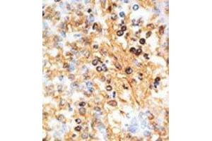 Image no. 2 for anti-Docking Protein 1, 62kDa (Downstream of tyrosine Kinase 1) (DOK1) (N-Term) antibody (ABIN359958)