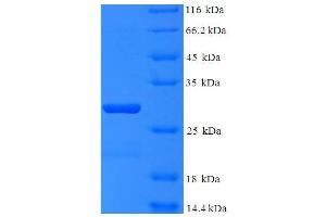 SDS-PAGE (SDS) image for Polymerase (RNA) III (DNA Directed) Polypeptide K, 12.3 KDa (POLR3K) (AA 1-108), (full length) protein (His-SUMO Tag) (ABIN5710125)