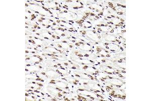 Immunohistochemistry of paraffin-embedded mouse stomach using Rad21 Rabbit pAb (ABIN7269822) at dilution of 1:200 (40x lens). (RAD21 anticorps)