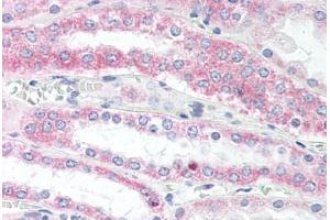 Human Kidney (formalin-fixed, paraffin-embedded) stained with VAMP5 antibody ABIN337073 at 10 ug/ml followed by biotinylated goat anti-rabbit IgG secondary antibody ABIN481713, alkaline phosphatase-streptavidin and chromogen. (VAMP5 anticorps  (N-Term))