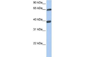 WB Suggested Anti-TKT Antibody Titration:  0. (TKT anticorps  (N-Term))