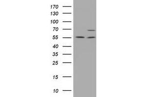 Western Blotting (WB) image for anti-Membrane Protein, Palmitoylated 3 (MAGUK P55 Subfamily Member 3) (MPP3) antibody (ABIN1499548) (MPP3 anticorps)
