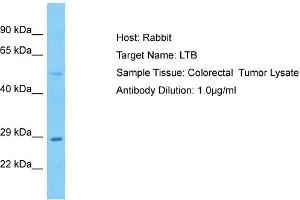 Host: Rabbit Target Name: LTB Sample Tissue: Human Colorectal Tumor Antibody Dilution: 1ug/ml