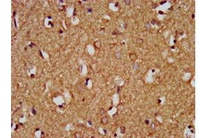 IHC image of ABIN7154814 diluted at 1:200 and staining in paraffin-embedded human brain tissue performed on a Leica BondTM system.