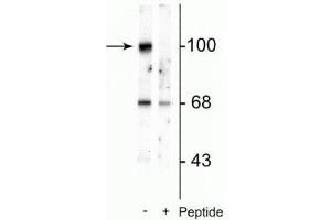 Western blot of rat brain lysate showing specific immunolabeling of the ~100 kDa GluR2 protein phosphorylated at Ser880 in the first lane (-). (GRIA2 anticorps  (pSer880))