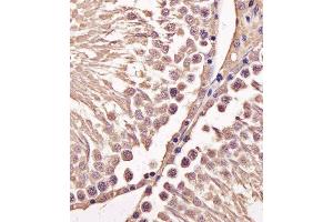 Immunohistochemical analysis of paraffin-embedded M.