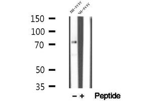 Western blot analysis of extracts of SH-SY5Y cells, using MECP2 antibody. (MECP2 anticorps  (C-Term))