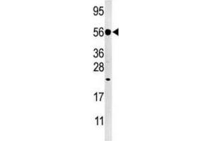 Western Blotting (WB) image for anti-Dual Specificity Phosphatase 8 (DUSP8) antibody (ABIN3003767) (DUSP8 anticorps)