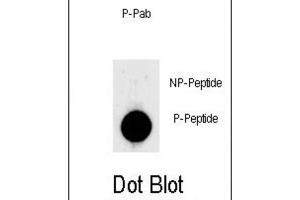 Dot Blot (DB) image for anti-Lin-28 Homolog A (C. Elegans) (LIN28A) (pSer134) antibody (ABIN3001930)