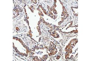 IHC analysis of FOXO3A using anti-FOXO3A antibody (ABIN3042404). (FOXO3 anticorps  (AA 471-673))