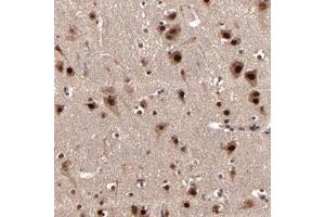 Immunohistochemical staining of human cerebral cortex with NXF5 polyclonal antibody  shows strong nuclear and moderate cytoplasmic positivity in neuronal cells at 1:10-1:20 dilution. (Nuclear RNA Export Factor 2B (NXF2B) anticorps)