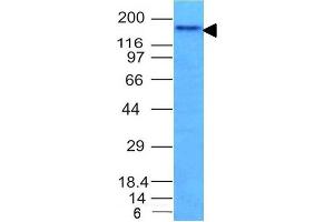 anti-Neural Cell Adhesion Molecule 1 (NCAM1) antibody