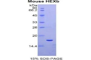 SDS-PAGE analysis of Mouse Hexosaminidase B beta Protein. (HEXB Protéine)