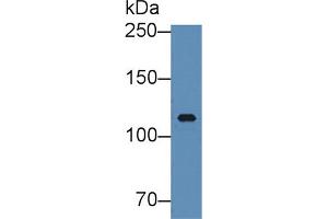 Western blot analysis of Human Serum, using Human ITIH3 Antibody (5 µg/ml) and HRP-conjugated Goat Anti-Rabbit antibody ( (ITIH3 anticorps  (AA 279-467))
