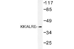 Image no. 1 for anti-Cyclin-Dependent Kinase-Like 1 (CDC2-Related Kinase) (CDKL1) antibody (ABIN272207) (CDKL1 anticorps)