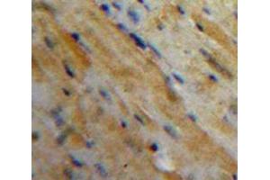 Used in DAB staining on fromalin fixed paraffin-embedded Heart tissue (MFAP5 anticorps  (AA 25-152))