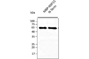 Western Blotting (WB) image for anti-SARS-CoV-2 Uridylate-Specific Endoribonuclease (NSP15) (N-Term) antibody (ABIN7273007) (SARS-CoV-2 NSP15 anticorps  (N-Term))