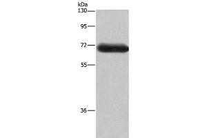 Western Blot analysis of Mouse brain tissue using DPYSL3 Polyclonal Antibody at dilution of 1:350 (DPYSL3 anticorps)