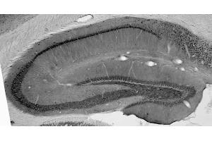Adult rat hippocampus immunohistochemistry.