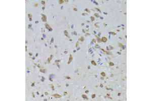 Immunohistochemistry of paraffin-embedded rat brain using RPL13 Antibody (ABIN2559760) at dilution of 1:100 (40x lens). (RPL13 anticorps)