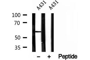 Western blot analysis of extracts of A431 cells, using HMGCS1 antibody. (HMGCS1 anticorps  (Internal Region))