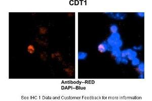 HC Suggested Anti-CDT1 antibody Titration:2 ug/ml Positive Control:Mouse brain stem cells (CDT1 anticorps  (C-Term))