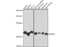 Western blot analysis of extracts of various cell lines, using LMO4 Rabbit mAb (ABIN7268258) at 1:1000 dilution. (LMO4 anticorps)