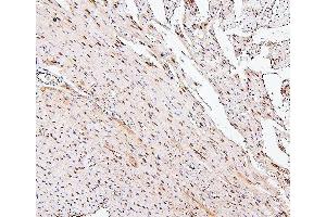 IHC analysis of PPCS using anti-PPCS antibody (ABIN7602752). (PPCS anticorps  (C-Term))