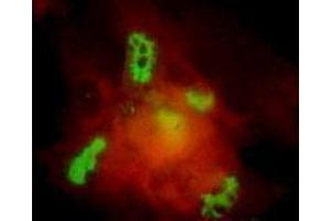 Immunofluorescence (IF) image for anti-Varicella Zoster Virus ORF62 (VZV IE62) antibody (ABIN265612) (Varicella Zoster Virus ORF62 (VZV IE62) anticorps)