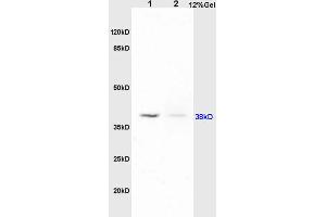 L1 rat lung lysates, L2 rat brain lysates probed (ABIN687127) Anti-PTAFR Polyclonal, Unconjugated at 1:200 in 4 °C.