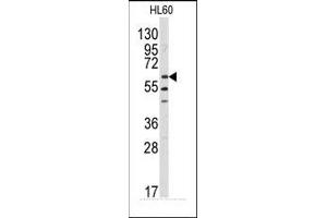 Image no. 1 for anti-V-Yes-1 Yamaguchi Sarcoma Viral Related Oncogene Homolog (LYN) (N-Term) antibody (ABIN359987) (LYN anticorps  (N-Term))