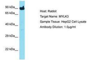 Image no. 1 for anti-Myosin Light Chain Kinase 3 (MYLK3) (C-Term) antibody (ABIN6750729) (MYLK3 anticorps  (C-Term))