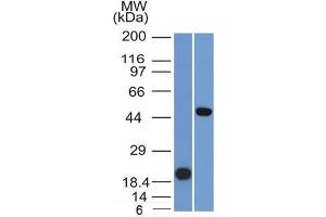 Western Blot Analysis (A) Recombinant Protein(B) Raji cell lysate UsingPAX8 Mouse Monoclonal Antibody (PAX8/1491). (PAX8 anticorps  (AA 60-261))
