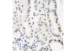Immunohistochemistry of paraffin-embedded human stomach using SFPQ antibody. (SFPQ anticorps)