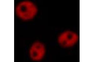 ABIN6266815 staining 293 by IF/ICC. (THRB anticorps  (Internal Region))
