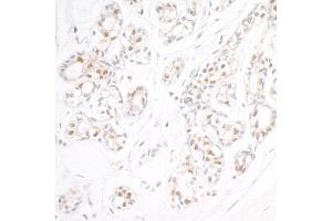 anti-Ubiquitin Interaction Motif Containing 1 (UIMC1) (C-Term) antibody