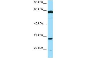 WB Suggested Anti-PMM2 AntibodyTitration: 1. (PMM2 anticorps  (Middle Region))