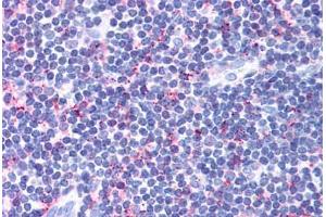 Human Tonsil (formalin-fixed, paraffin-embedded) stained with CCR4 antibody ABIN213490 at 10 ug/ml followed by biotinylated goat anti-rabbit IgG secondary antibody ABIN481713, alkaline phosphatase-streptavidin and chromogen.