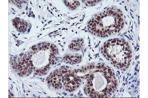 Immunohistochemical staining of paraffin-embedded Human breast tissue using anti-TIMP2 mouse monoclonal antibody. (TIMP2 anticorps)