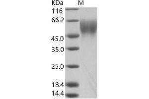 Western Blotting (WB) image for Zaire Ebola Virus Envelope Glycoprotein (ZEBOV GP) protein (ABIN7198929) (ZEBOV GP Protéine)