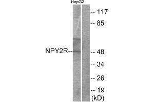 Western blot analysis of extracts from HepG2 cells, using NPY2R antibody. (NPY2R anticorps  (N-Term))