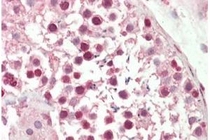 Human, Testis: Formalin-Fixed Paraffin-Embedded (FFPE)