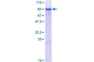 Image no. 1 for 3'-phosphoadenosine 5'-phosphosulfate Synthase 1 (PAPSS1) (AA 1-603) protein (GST tag) (ABIN1313976)