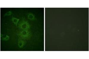 Immunofluorescence analysis of HuvEc cells, using BIK (Ab-33) Antibody. (BIK anticorps  (AA 18-67))